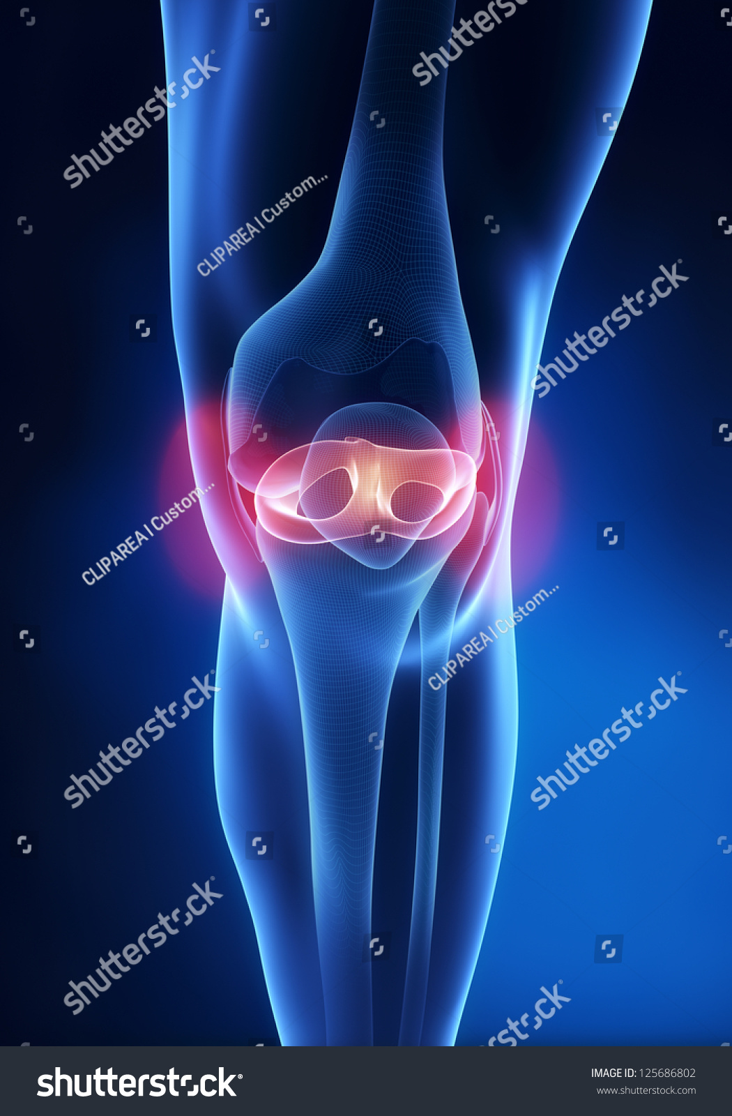 Meniscal Injuries Stock Illustration 125686802 | Shutterstock