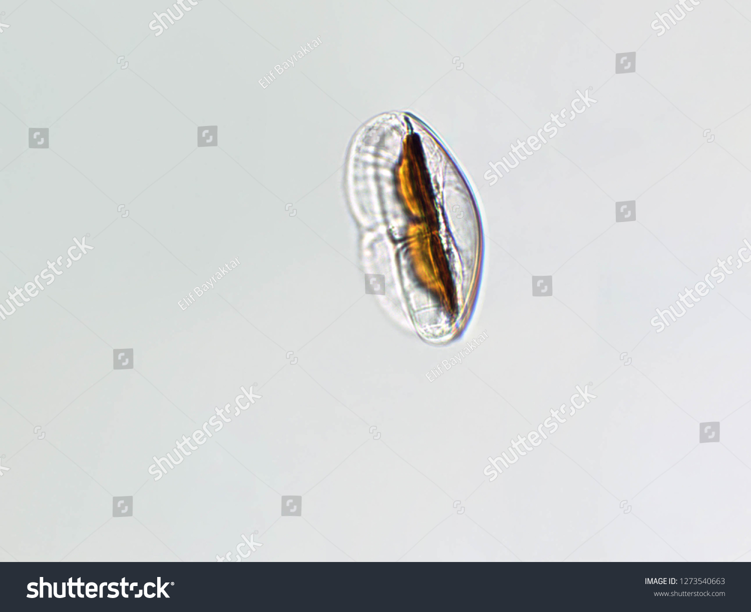 Amphora Sp Algae Under Microscopic View Stock Photo 1273540663 ...