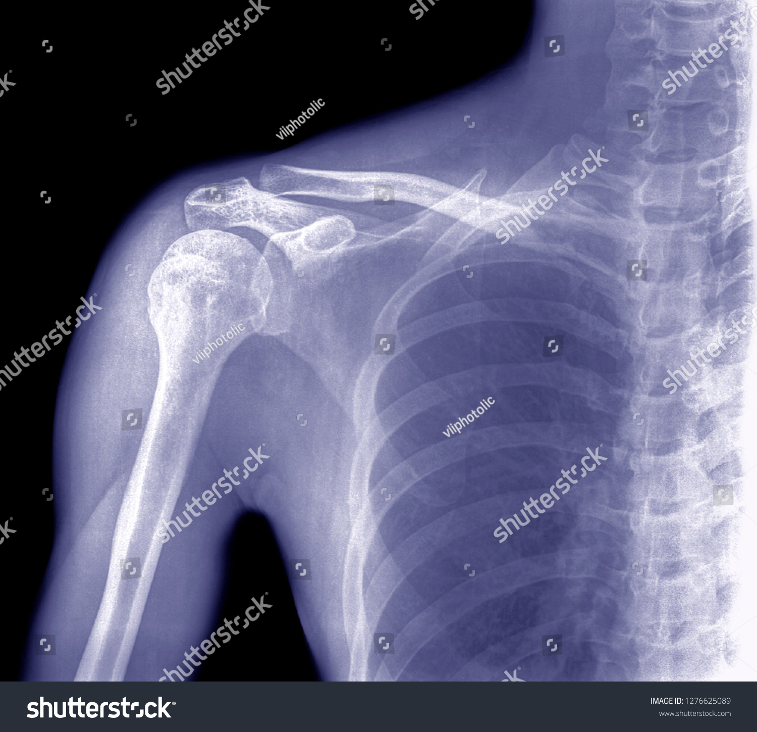 human shoulder bone structure