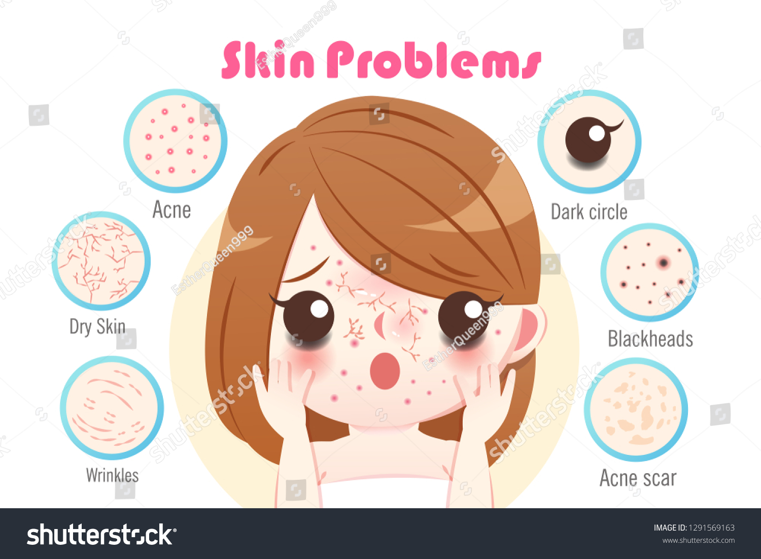 Cute Cartoon Woman Skin Problem On Stock Vector (Royalty Free ...