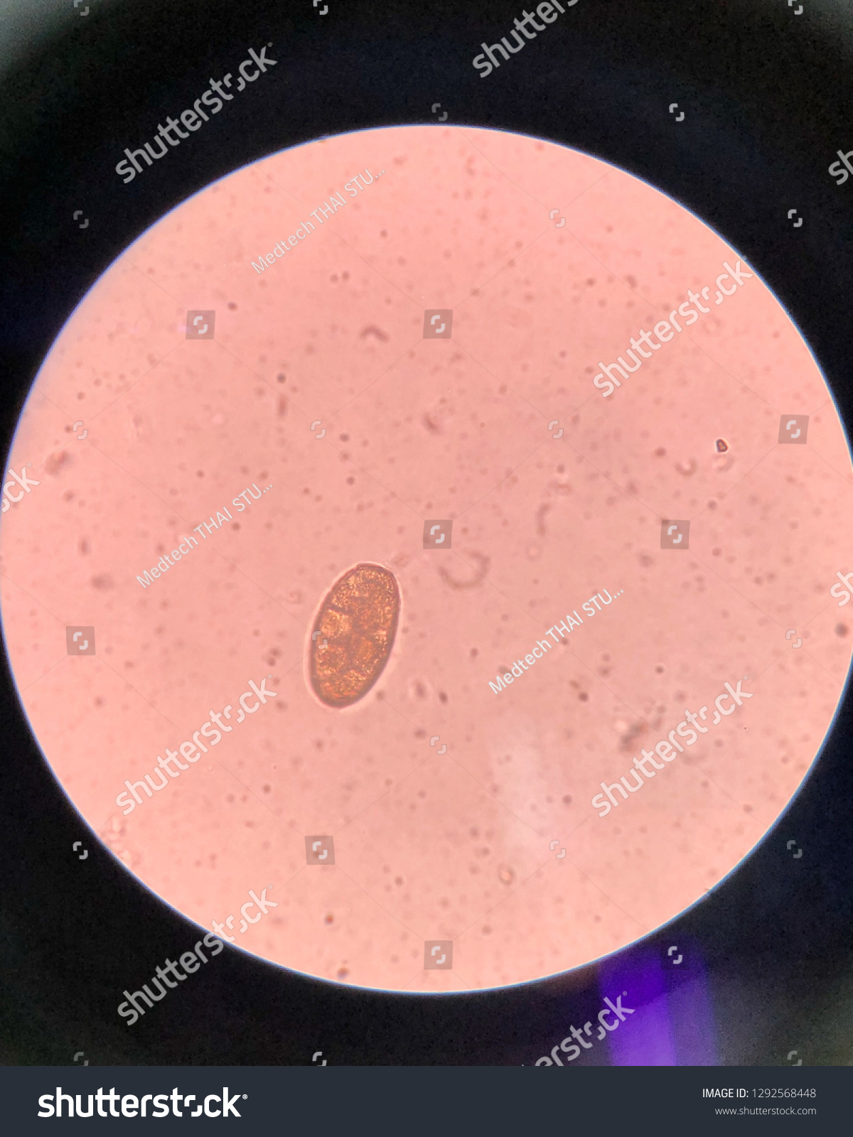 paragonimus westermani egg size