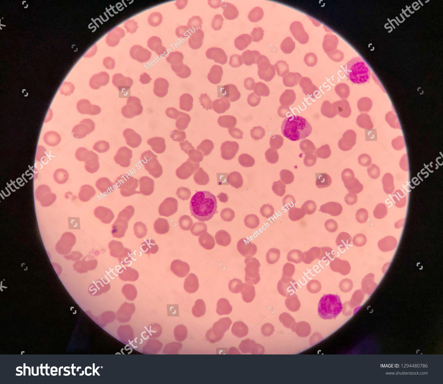 Under Microscope Showing Cell Stock Photo 1294480786 Shutterstock