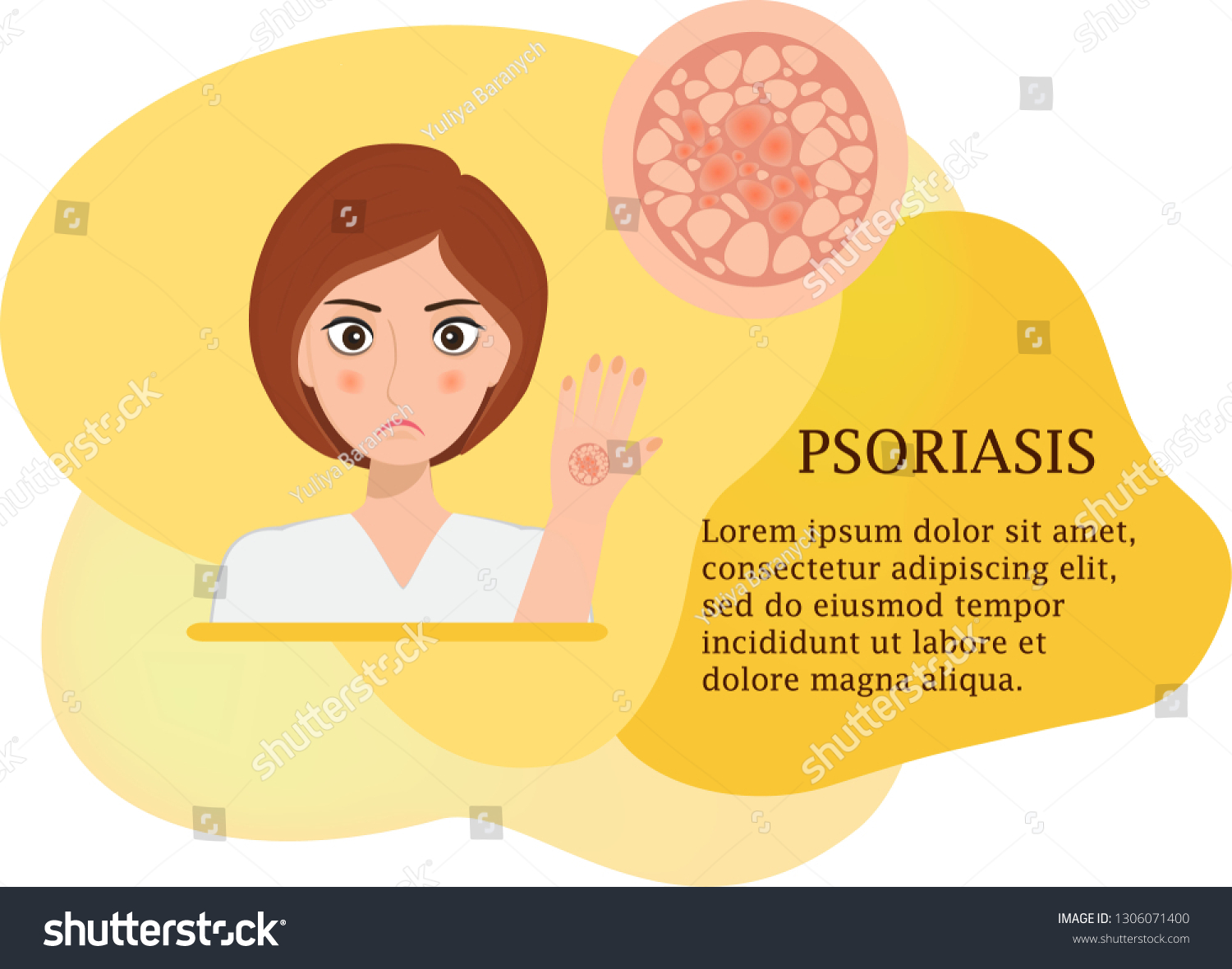 Concept Psoriasis Vector Poster Fluid Background Stock Vector (Royalty ...