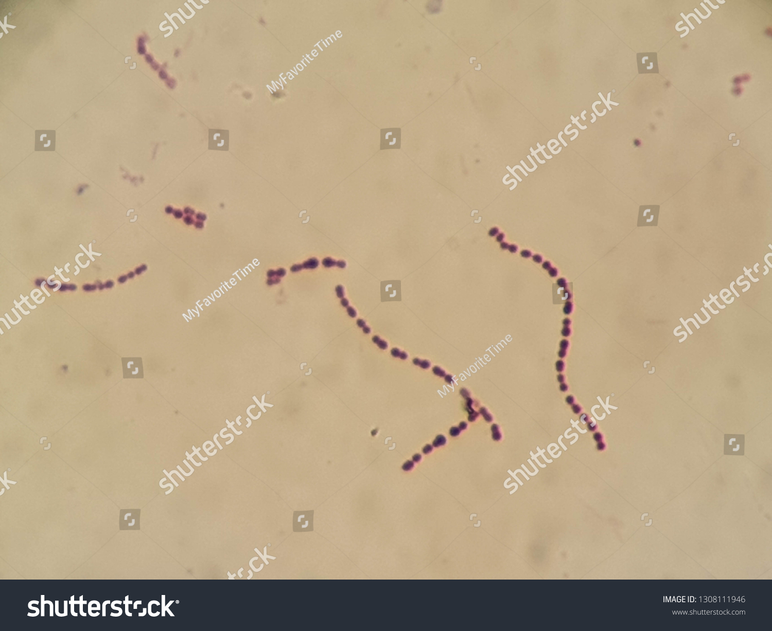 Chracteristic Gram Positive Cocci Chains Streptococcus Stock Photo ...