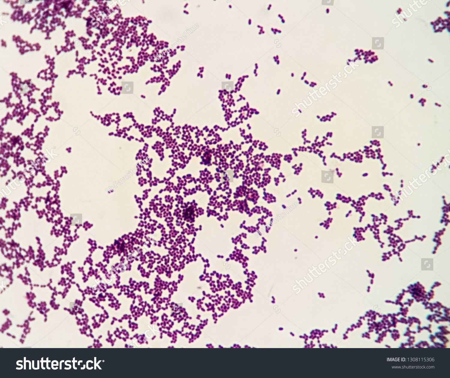 Gram Positive Cocci Cluster Stapylococcus Spp Stock Photo 1308115306 ...