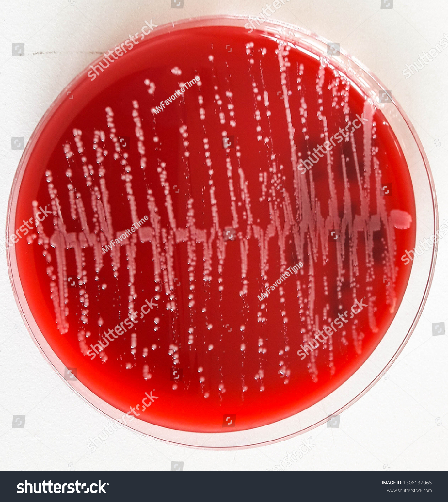 Many Colonies Bacterial Culture On Blood Stock Photo 1308137068 ...