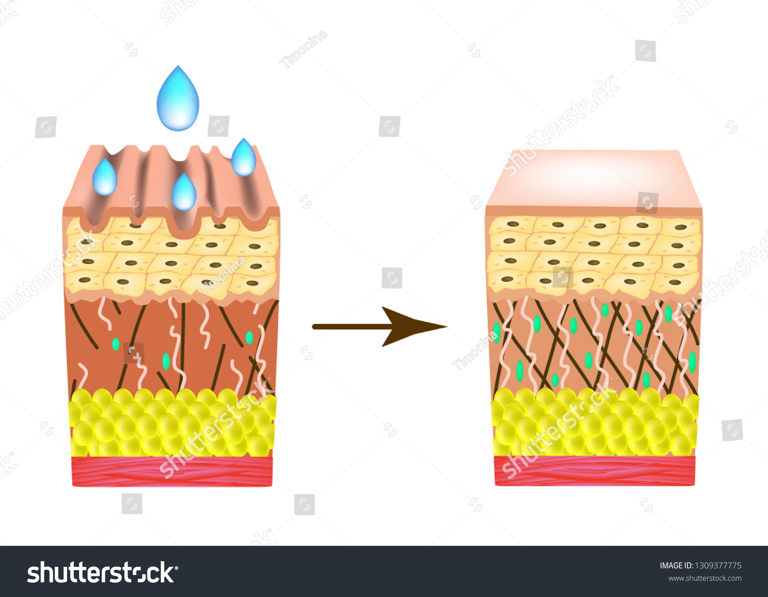 Wrinkles On Skin Collagen Deficiency Impact Stock Illustration ...