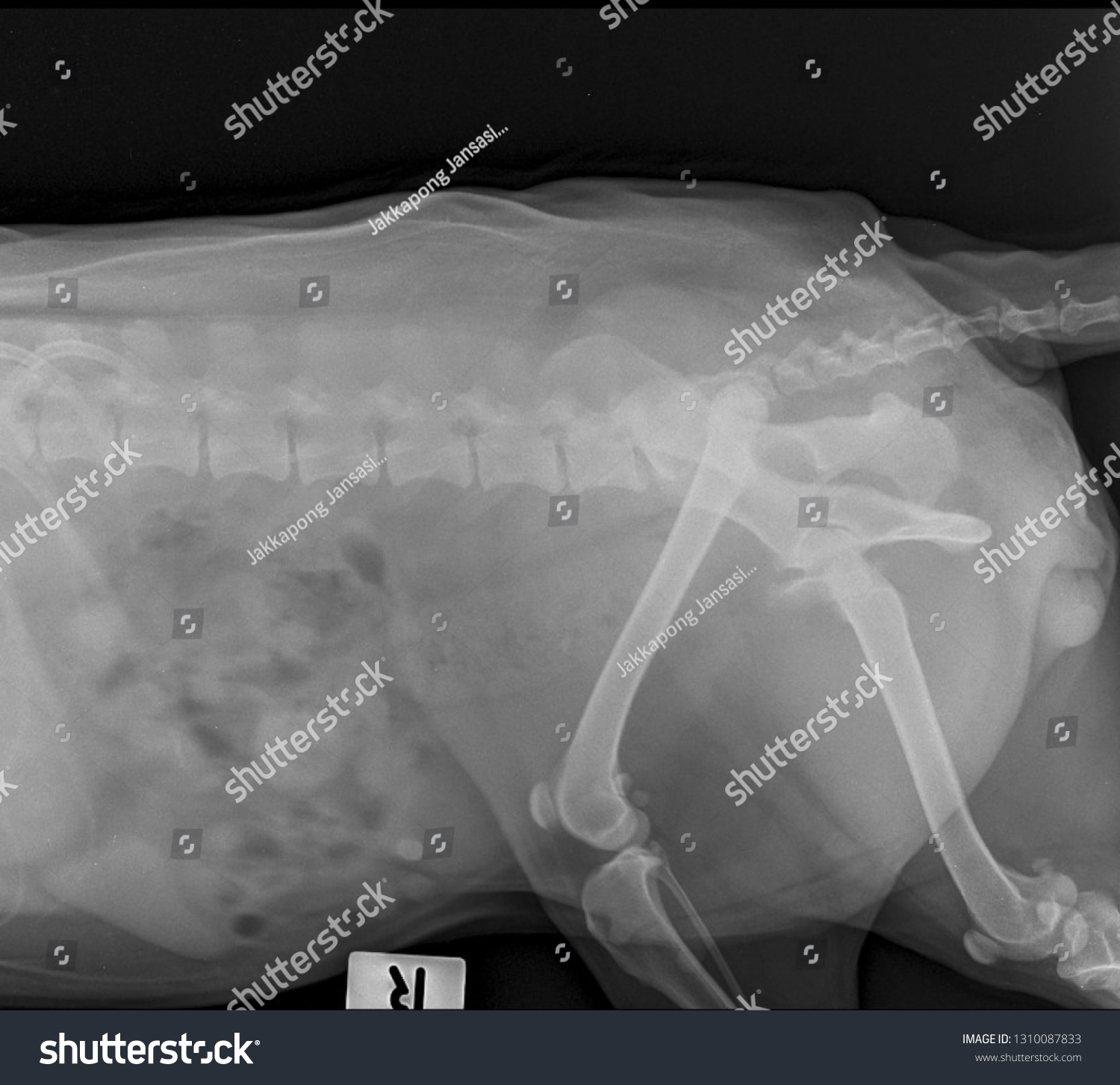 X Ray Right Hip Dislocation Side Stock Photo 1310087833 | Shutterstock