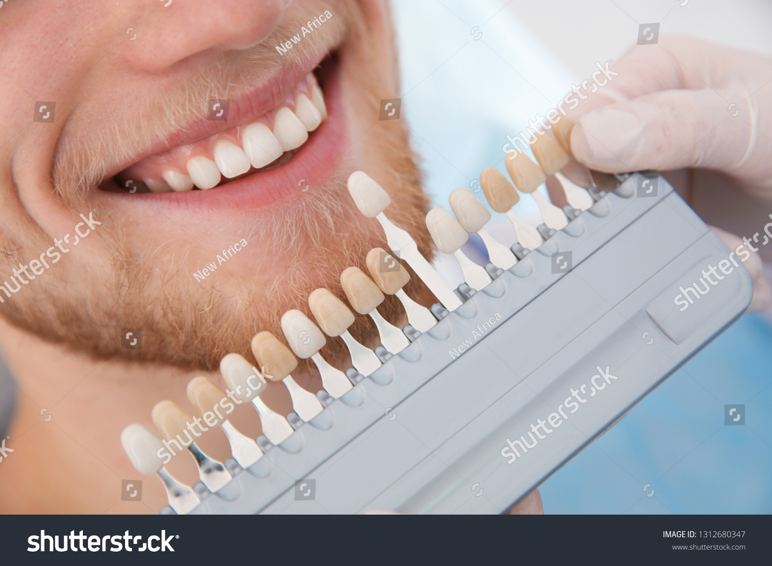 Красивый цвет зубов мужчина
