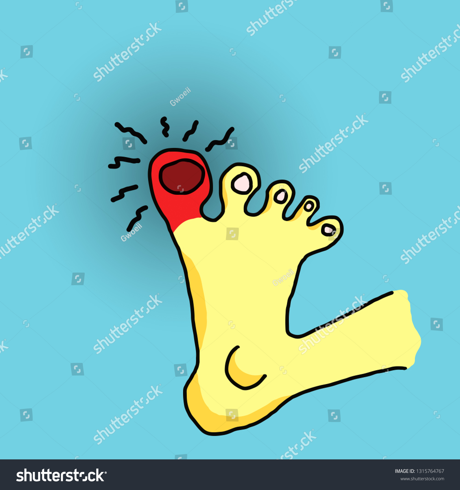 Cartoon Feet Throbbing Swollen Toe Vector: เวกเตอร์สต็อก (ปลอดค่า ...