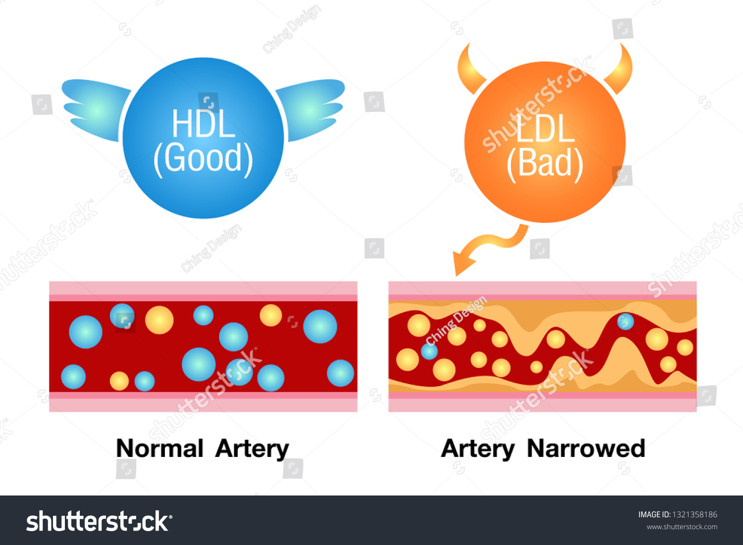 Good Bad Cholesterol Health Risk Vector Stock Vector (Royalty Free ...