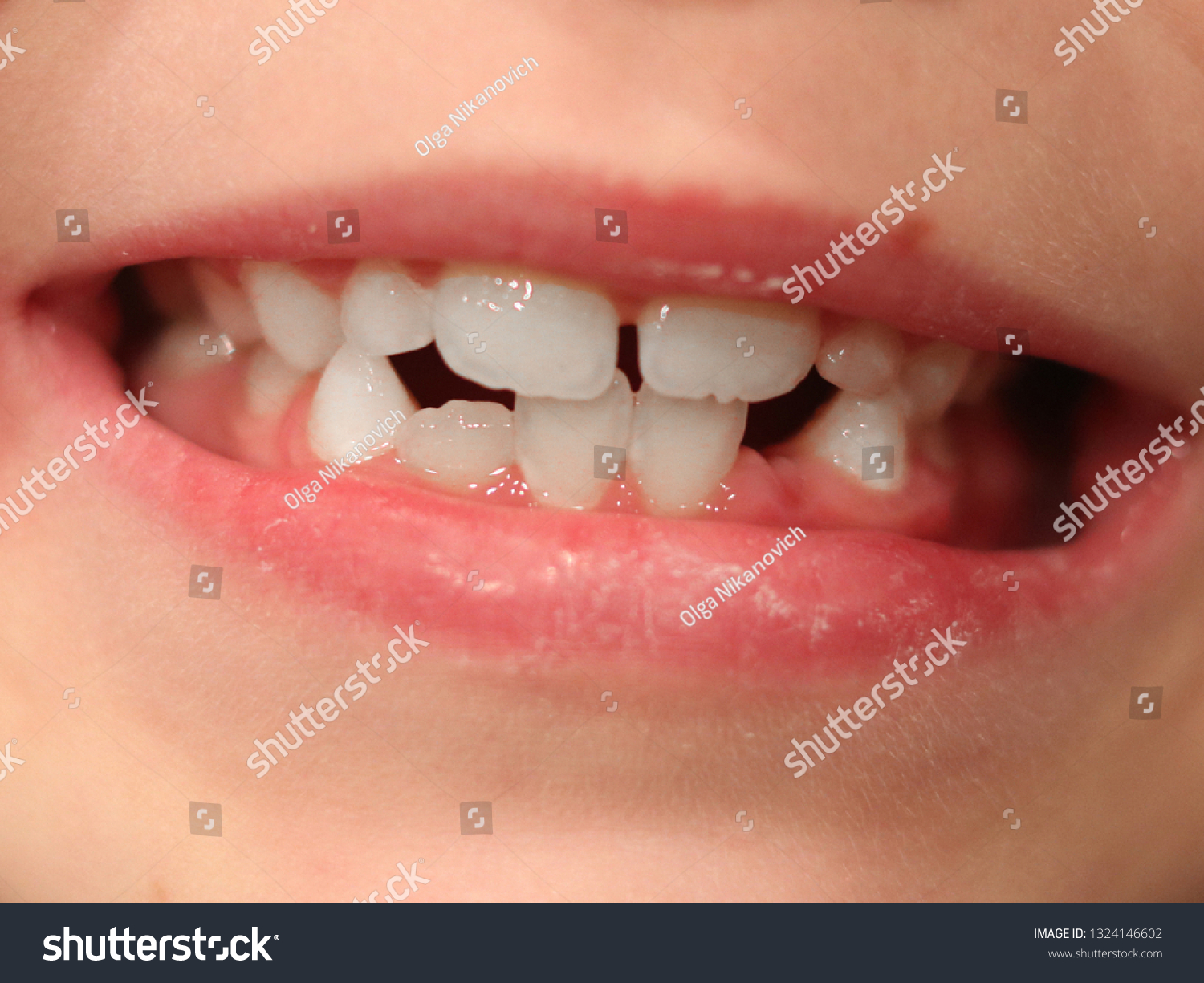 Child Showing Teeth Mouth Teethless Milk Stock Photo 1324146602