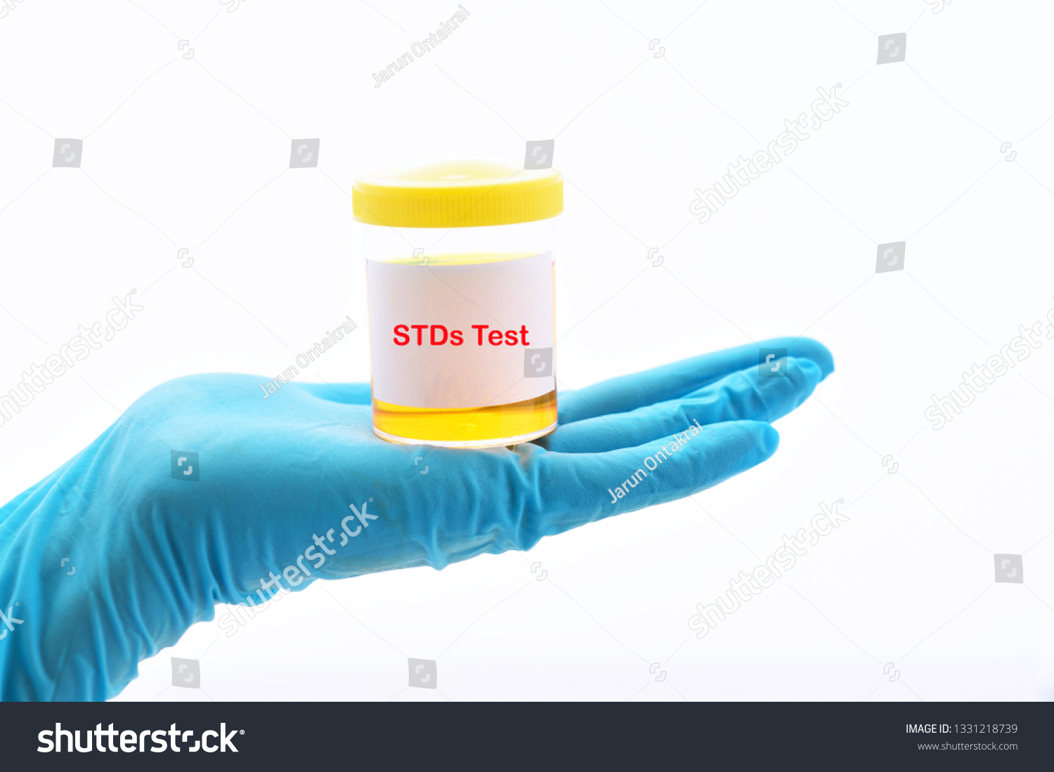 Urine Sample Sexually Transmitted Diseases Stds Stock Photo 1331218739