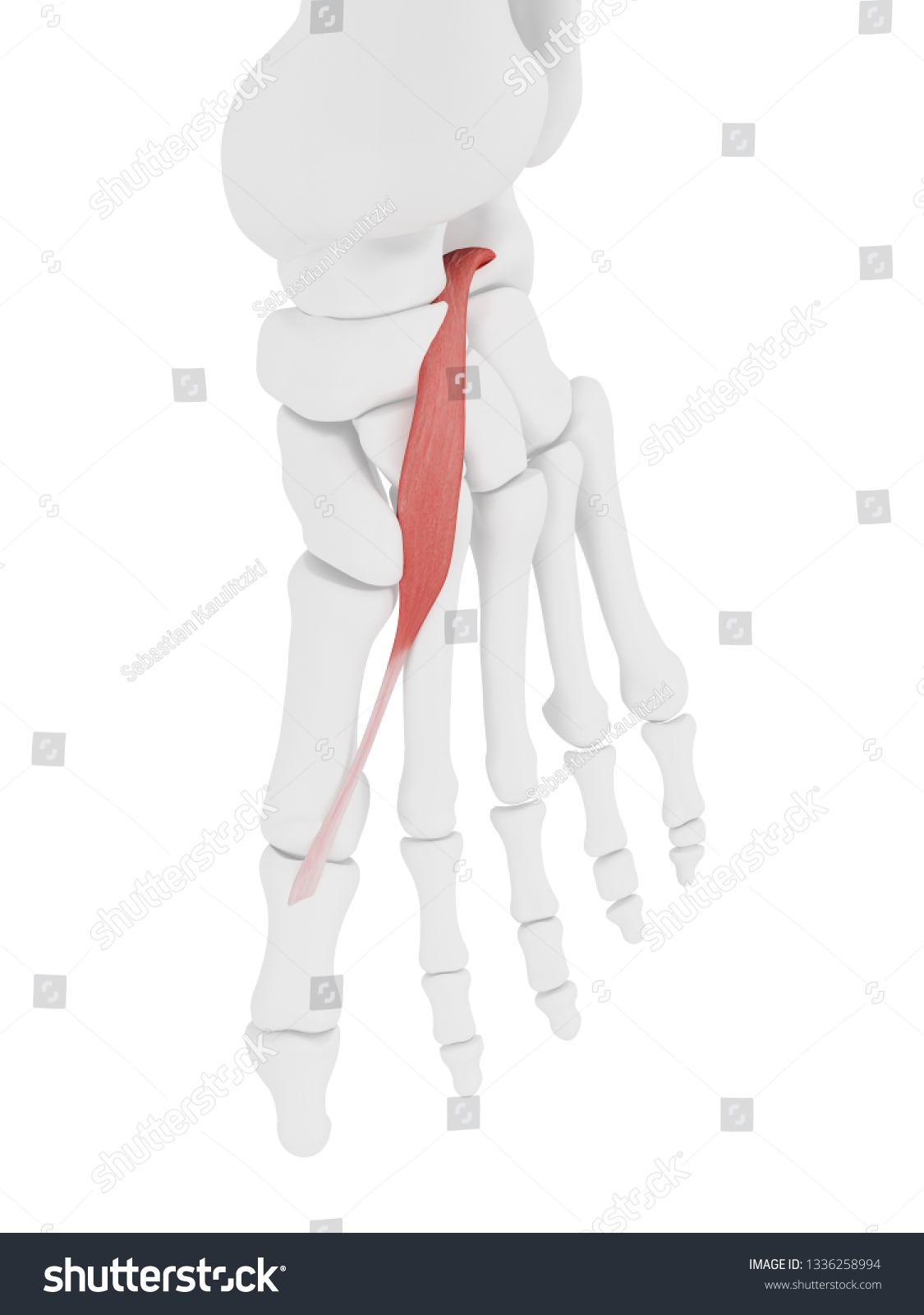 423 Extensor Hallucis Brevis Images, Stock Photos & Vectors | Shutterstock