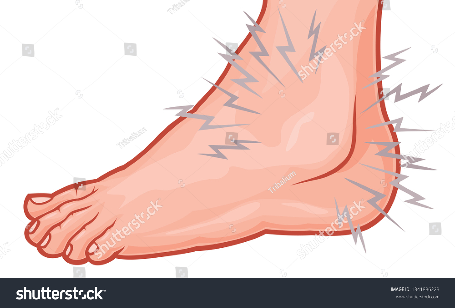 Ankle Sprain Vector Illustration Stock Vector (Royalty Free) 1341886223 ...