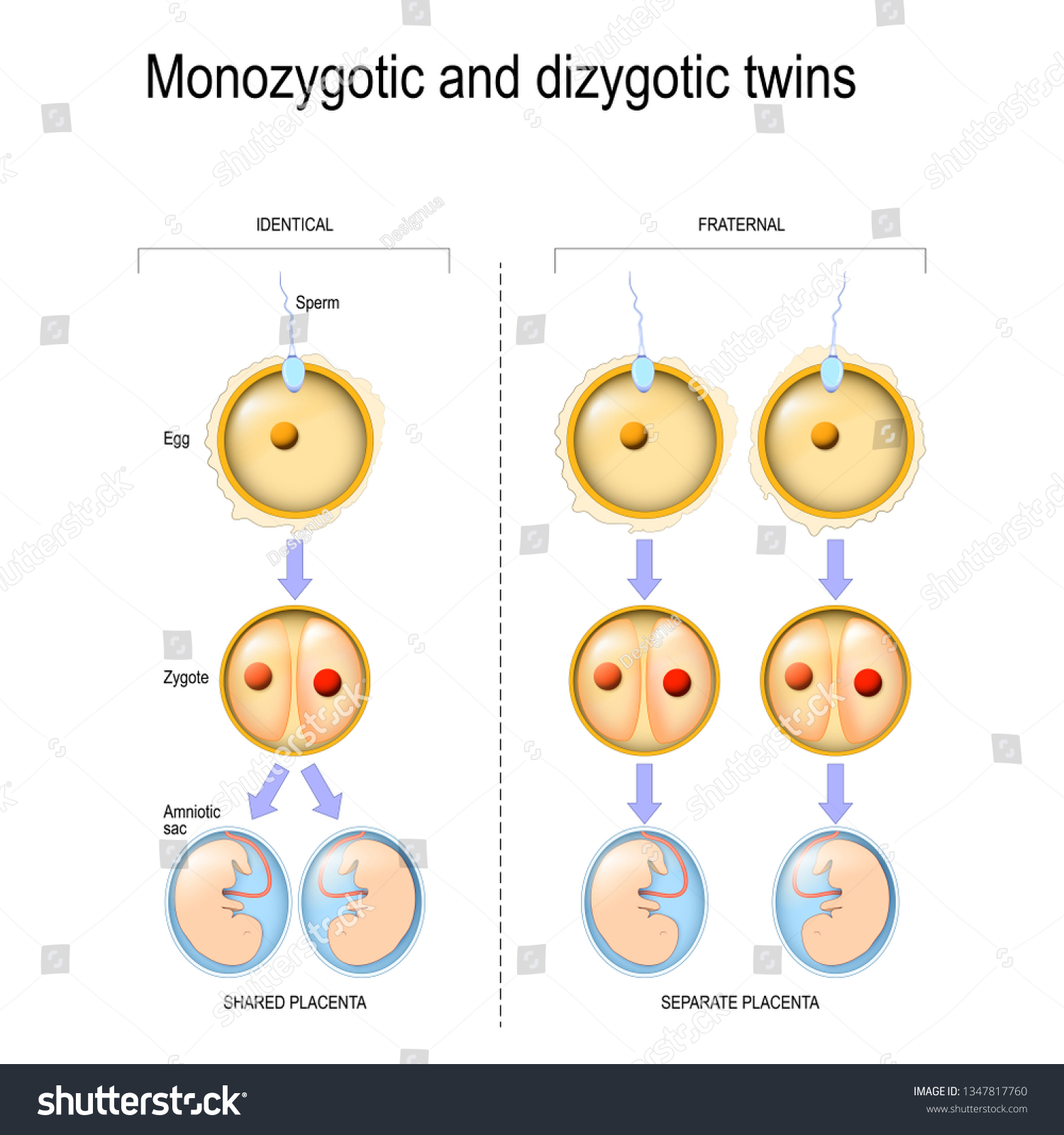 Difference Comparison Zygote Development Monozygotic Dizygotic ...