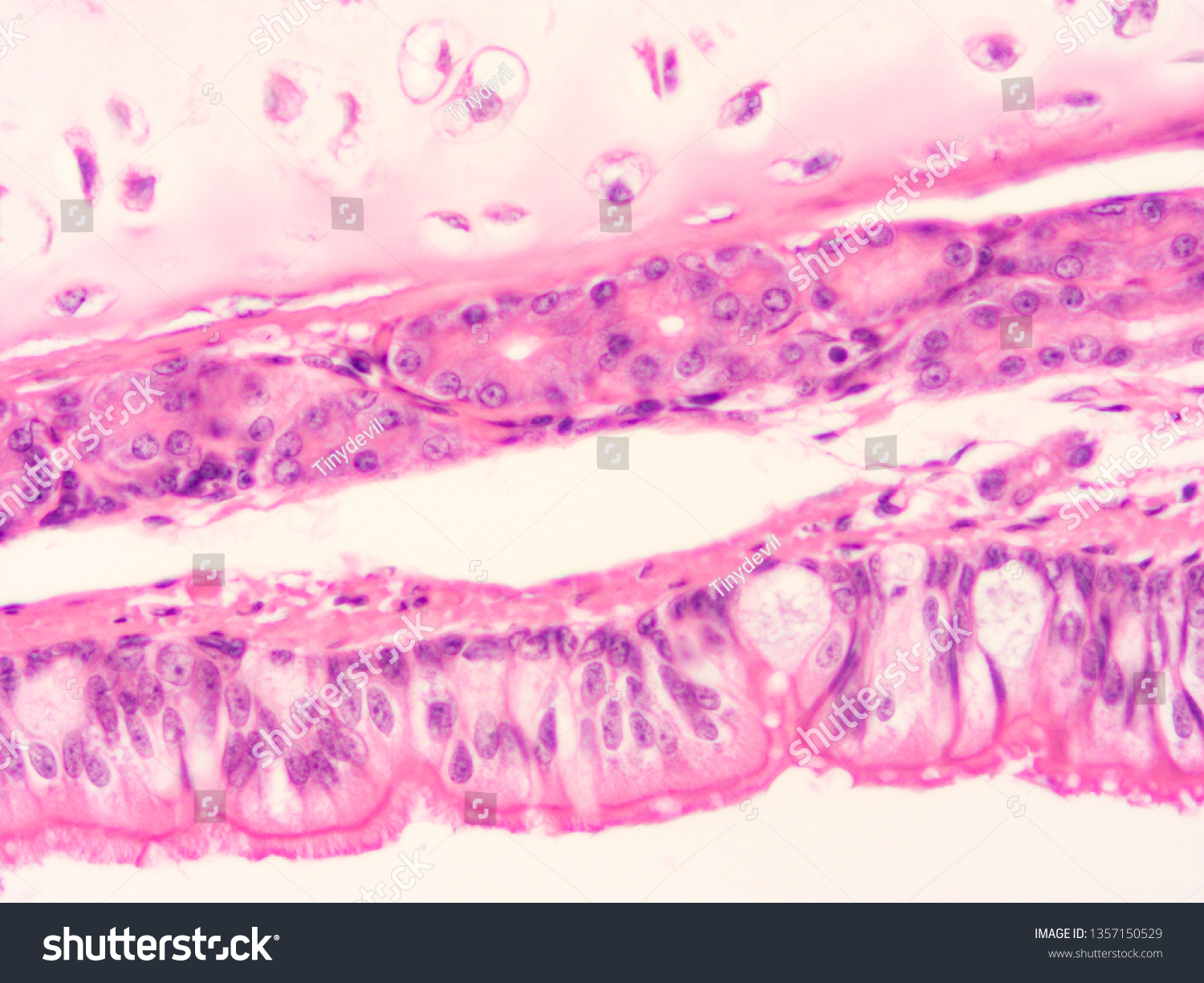 Trachea Cartilage Rings Human Tissue Stock Photo 1357150529 | Shutterstock