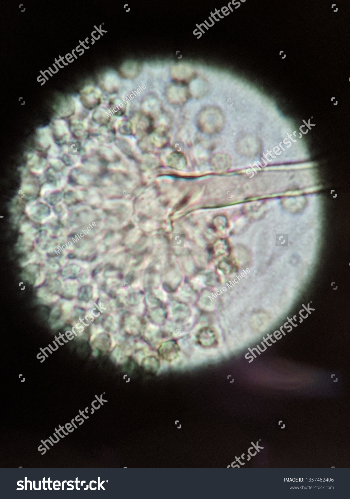 Microscopic View Aspergillus Sp Stock Photo 1357462406 | Shutterstock