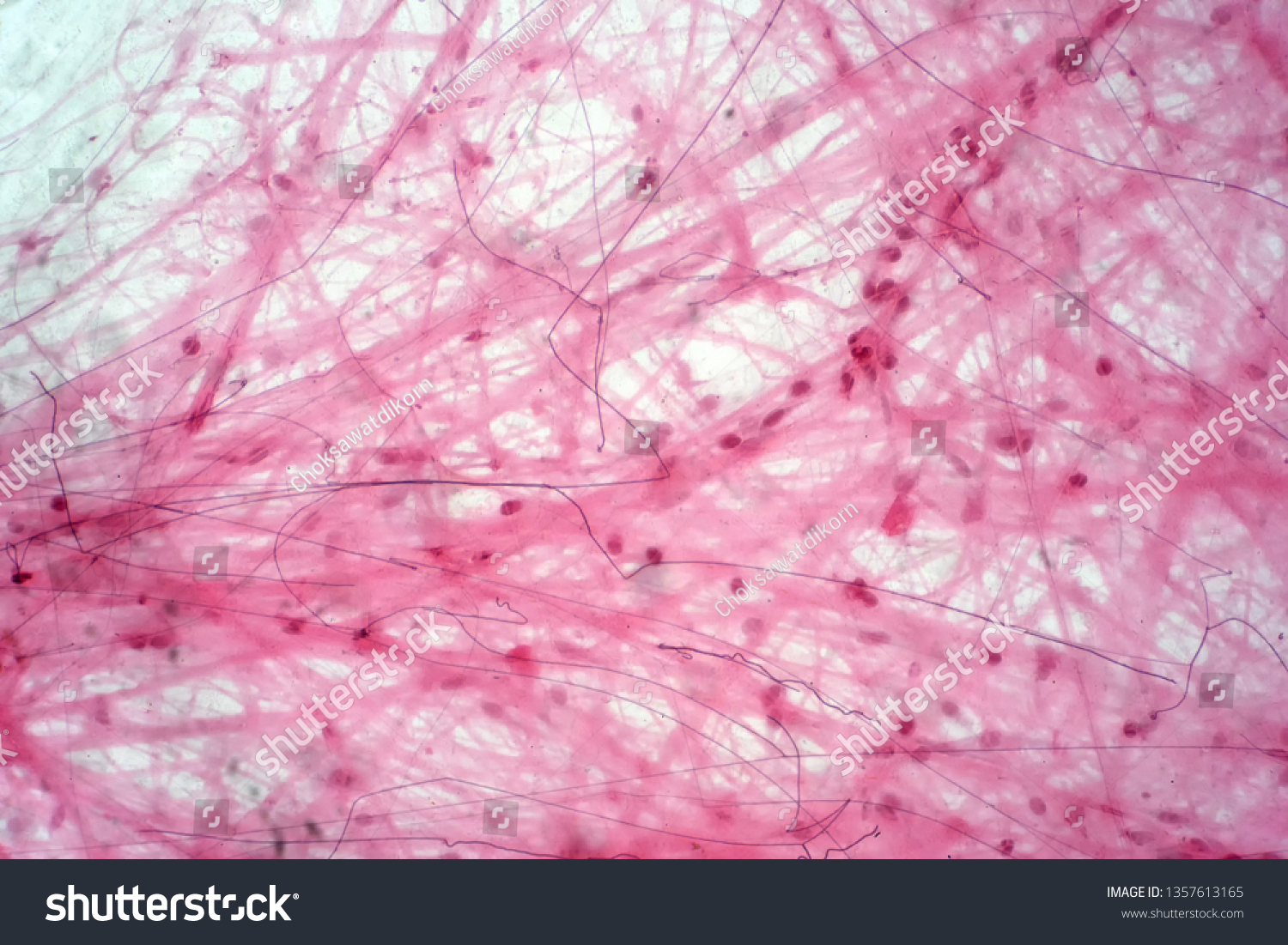 Areolar Connective Tissue Under Microscope View Stock Photo 1357613165 ...