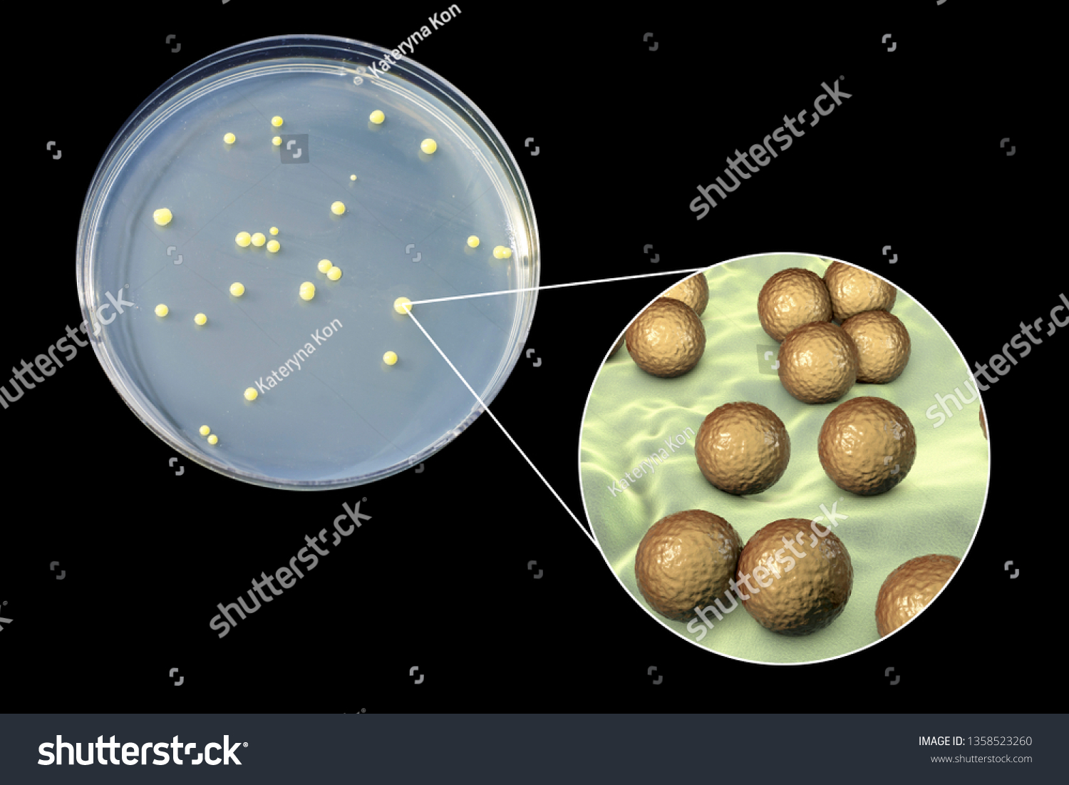 Colonies Micrococcus Luteus Bacteria On Agar Stock Illustration ...