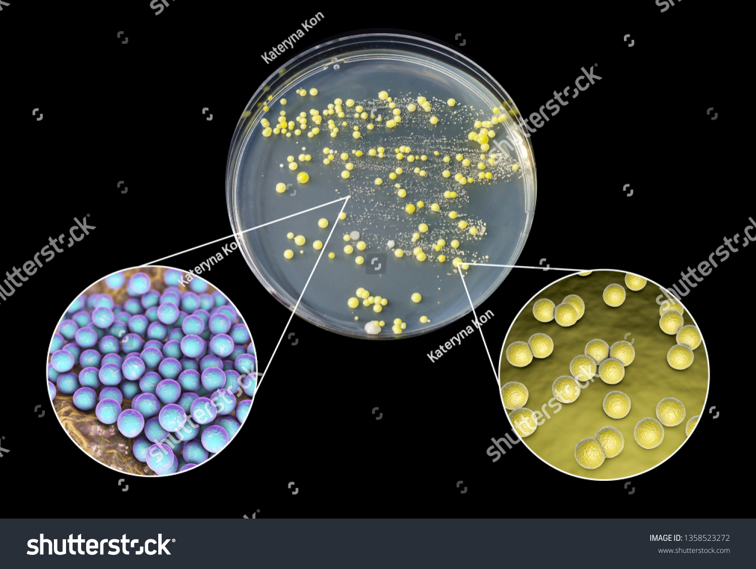 Colonies Bacteria Grown Human Skin Smear Stock Illustration 1358523272 ...