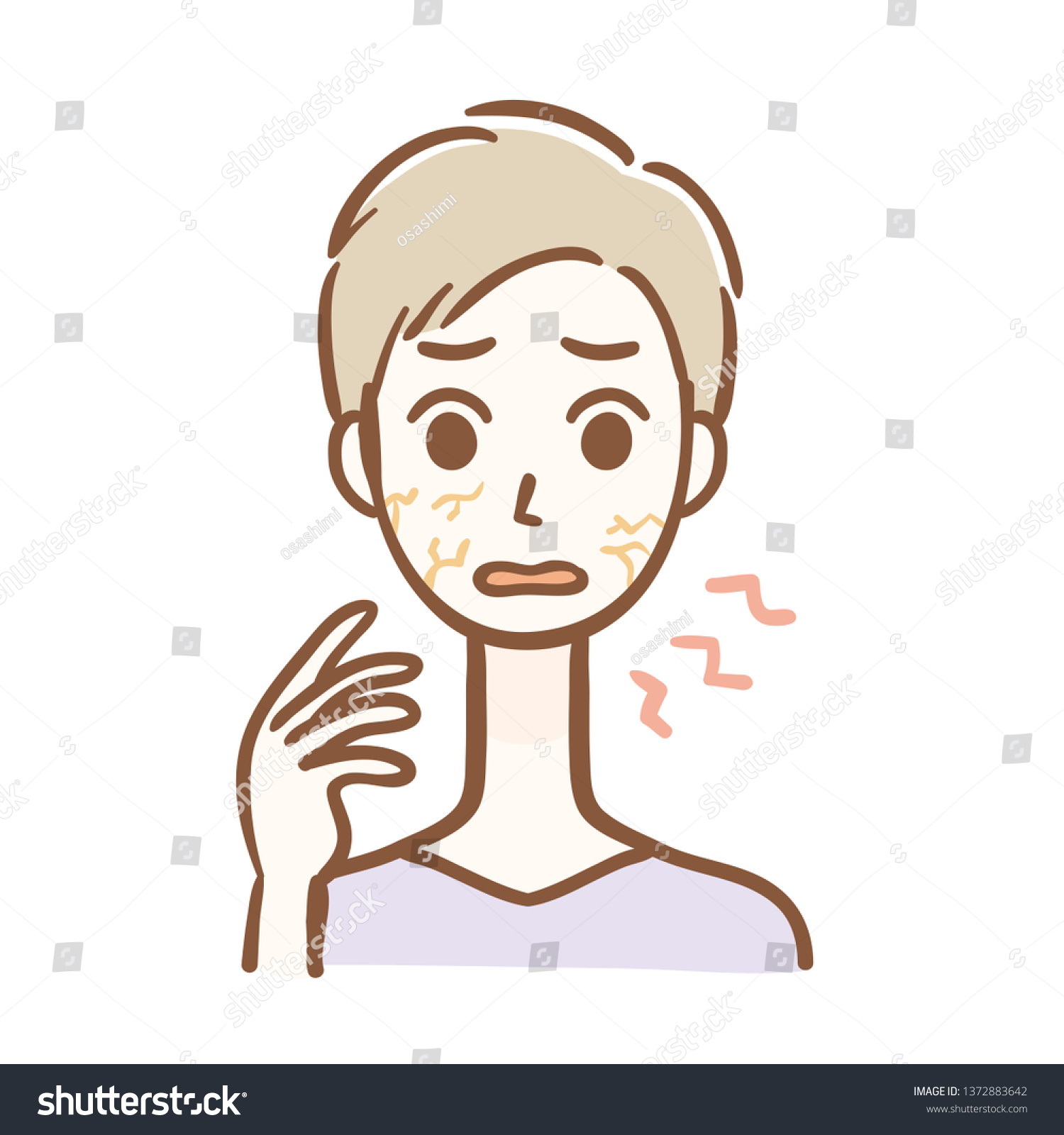 Illustration Man Dry Skin Stock Vector Royalty Free 1372883642 Shutterstock 