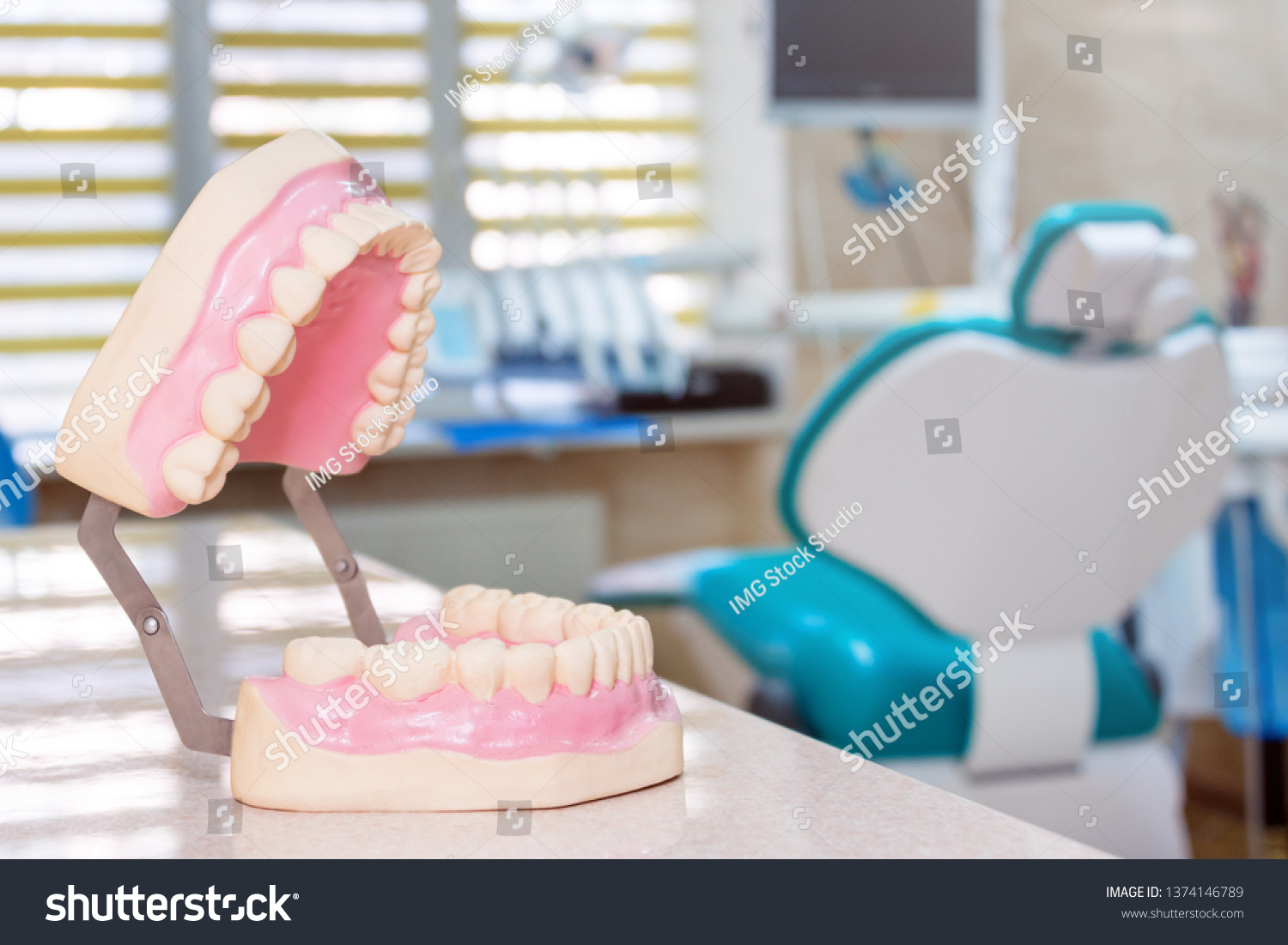 Human Jaw Models Dentist Office Teeth Stock Photo 1374146789 Shutterstock