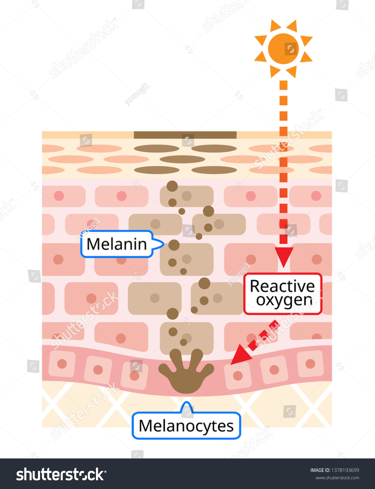 Melanin Facial Dark Spots Skin Layer Stock Vector (Royalty Free ...