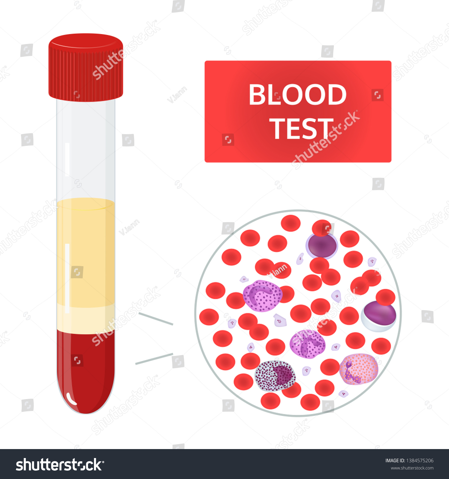 Medical Vector Concept Blood Analysis Test Stock Vector (Royalty Free ...