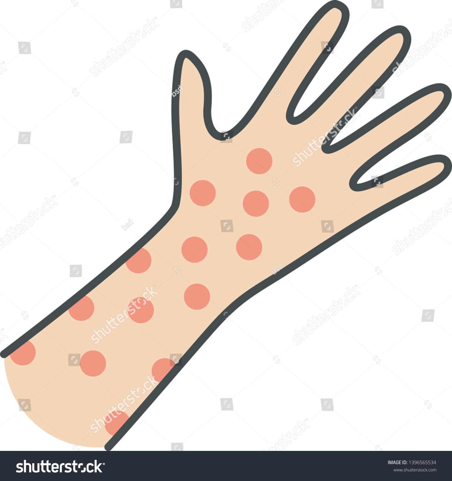 Skin Rash Hives Color Icon Food Stock Vector (Royalty Free) 1396565534 ...