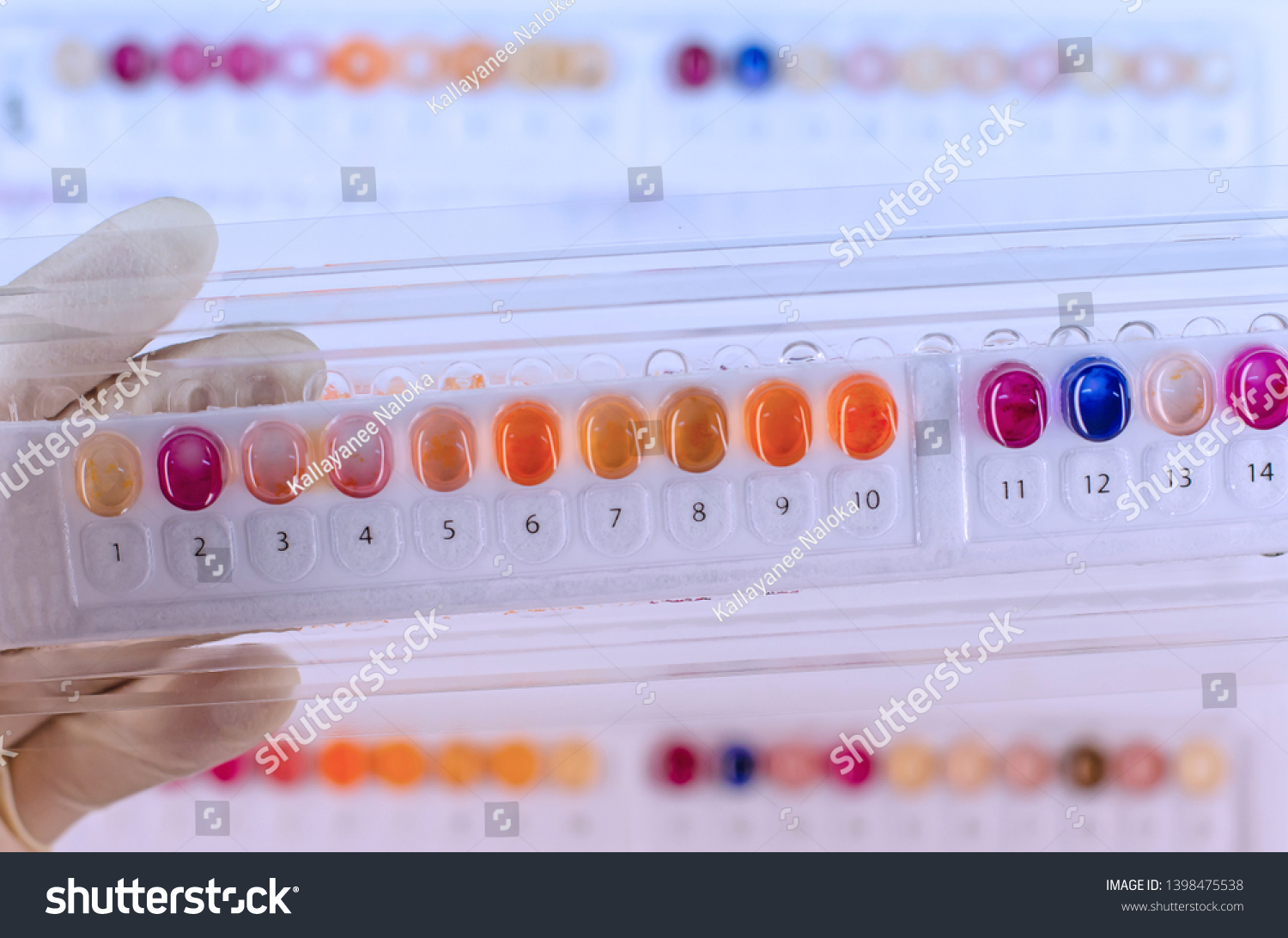 Biochemical Test Kit Microorganism Identification Stock Photo ...