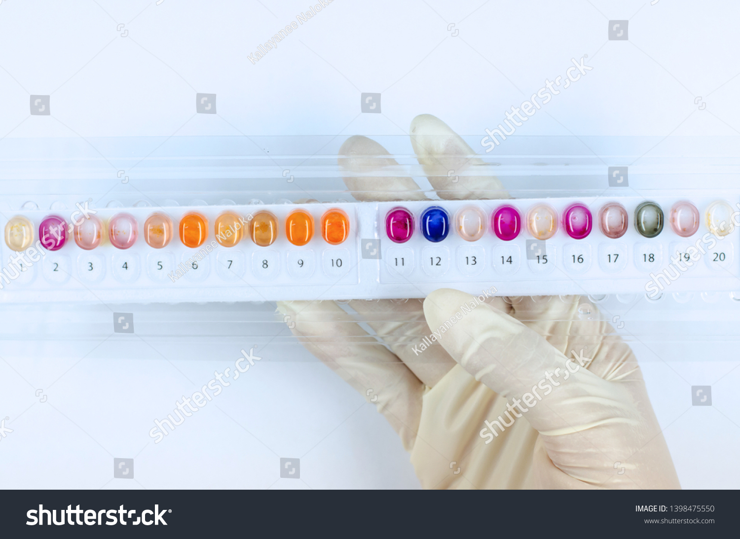 Biochemical Test Kit Microorganism Identification Stock Photo ...