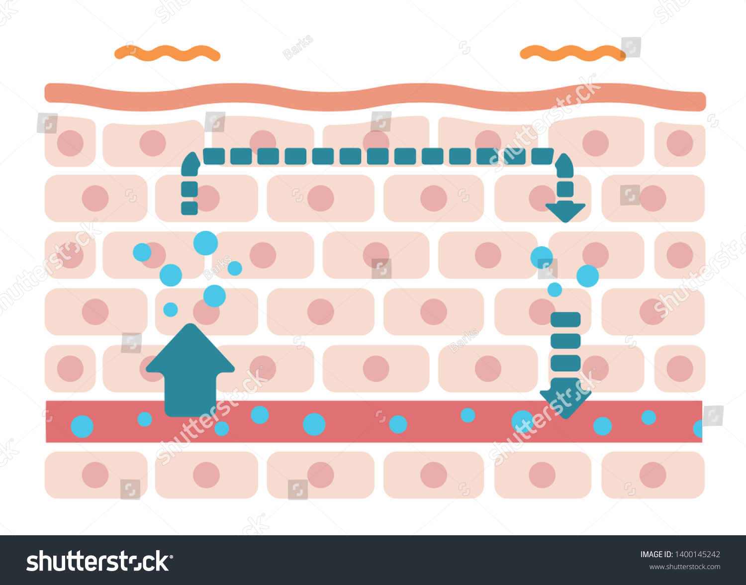 Illustration Swollen Skin Condition Malfunction Moisture Stock Vector ...