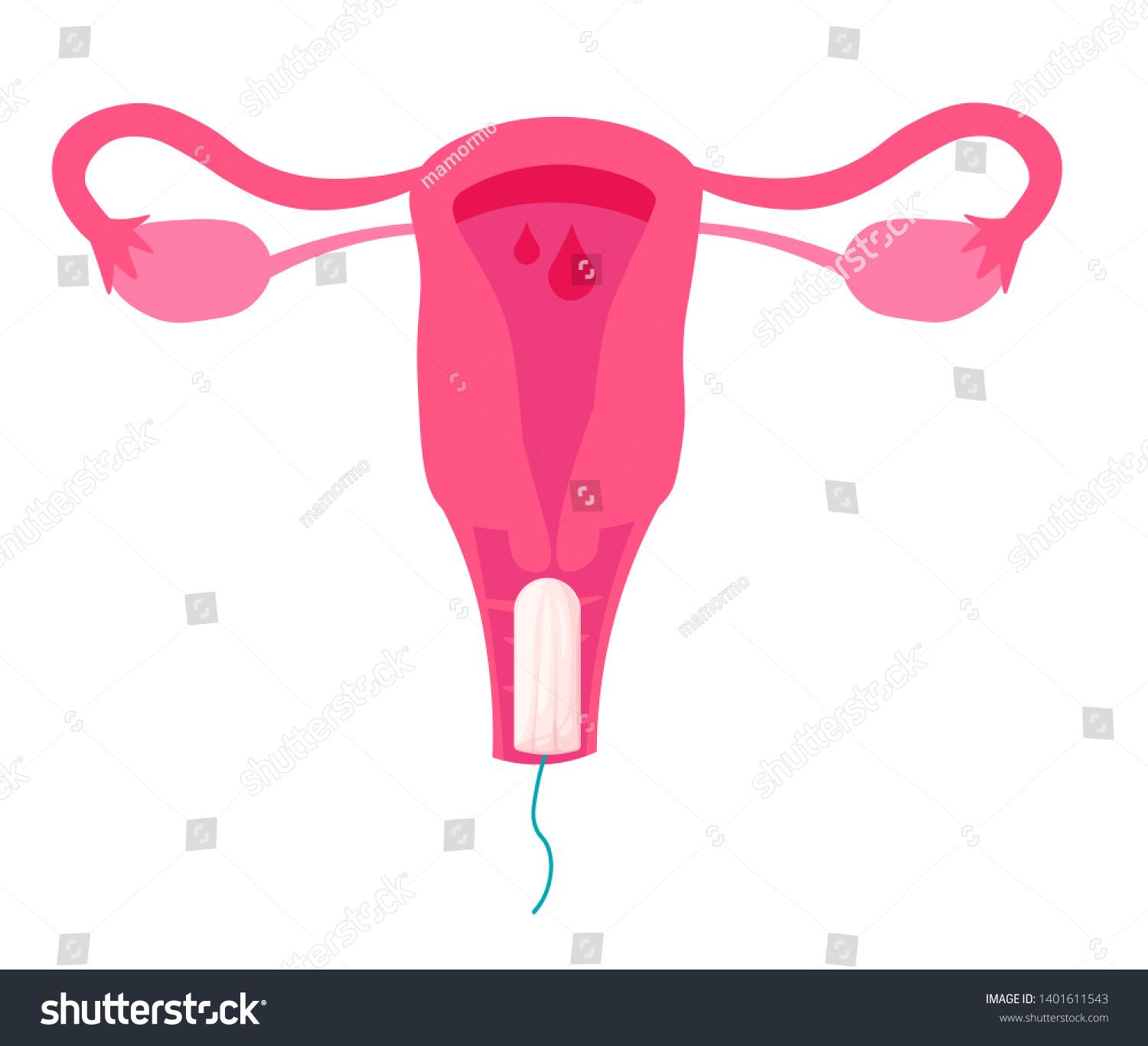 Female Reproductive System Vagina Uterus Tampon: Εικονογράφηση μόδας 140161...