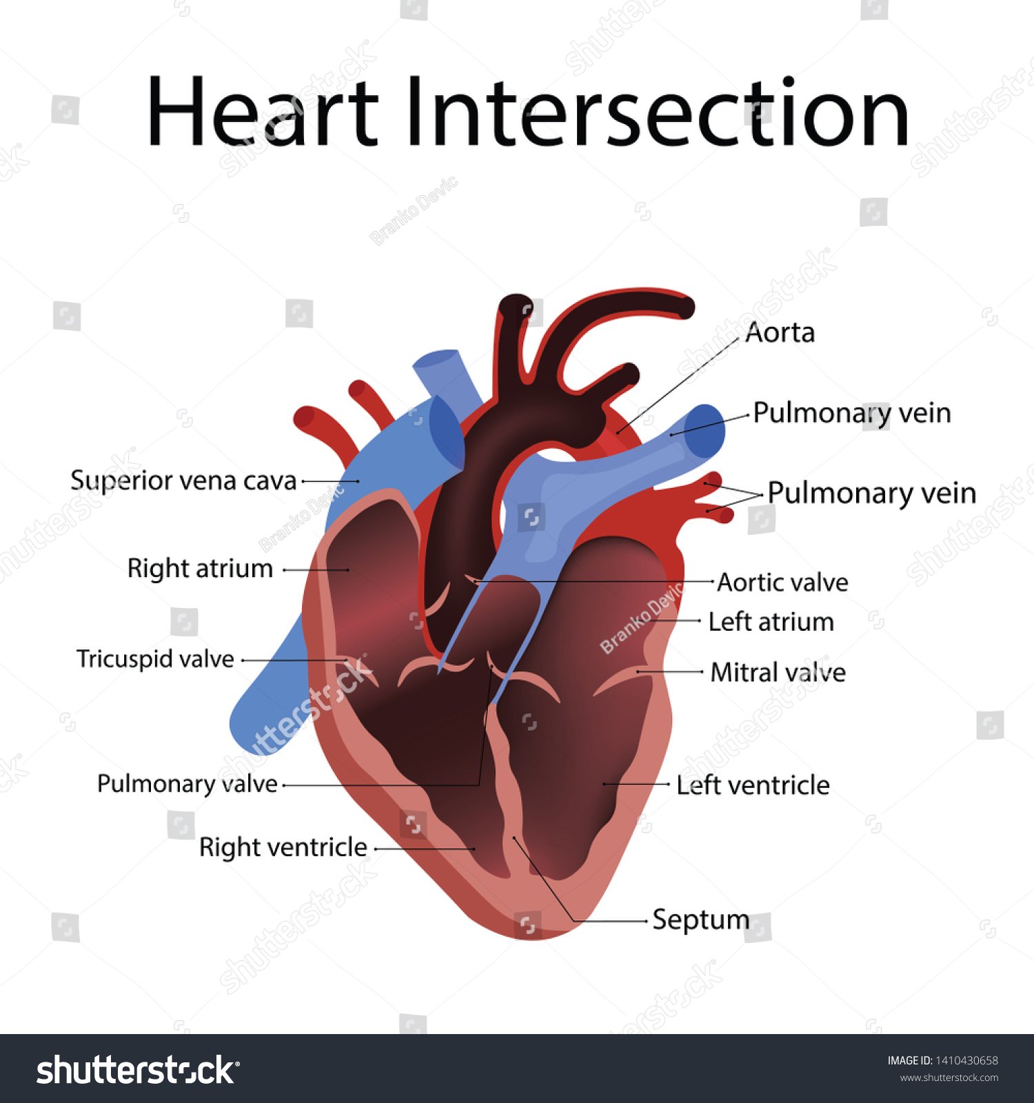Heart Anatomy Types Heart Disease Illustration Stock Illustration ...