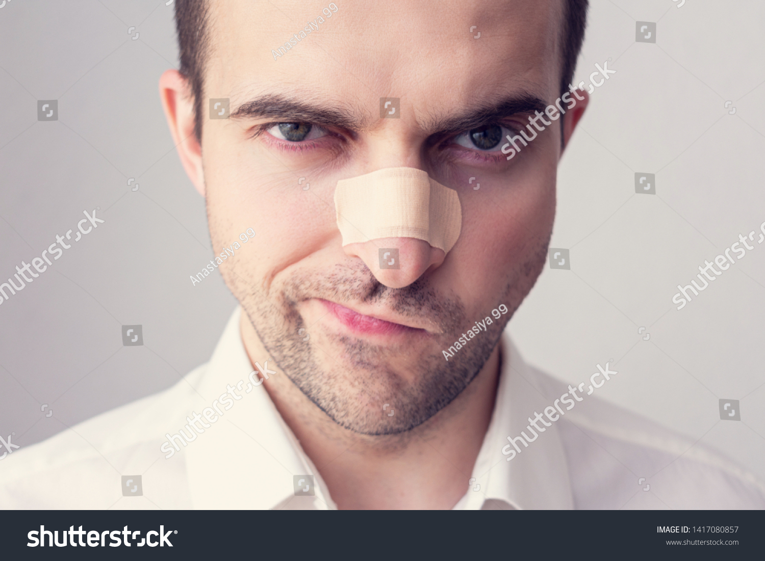 broken nose close up