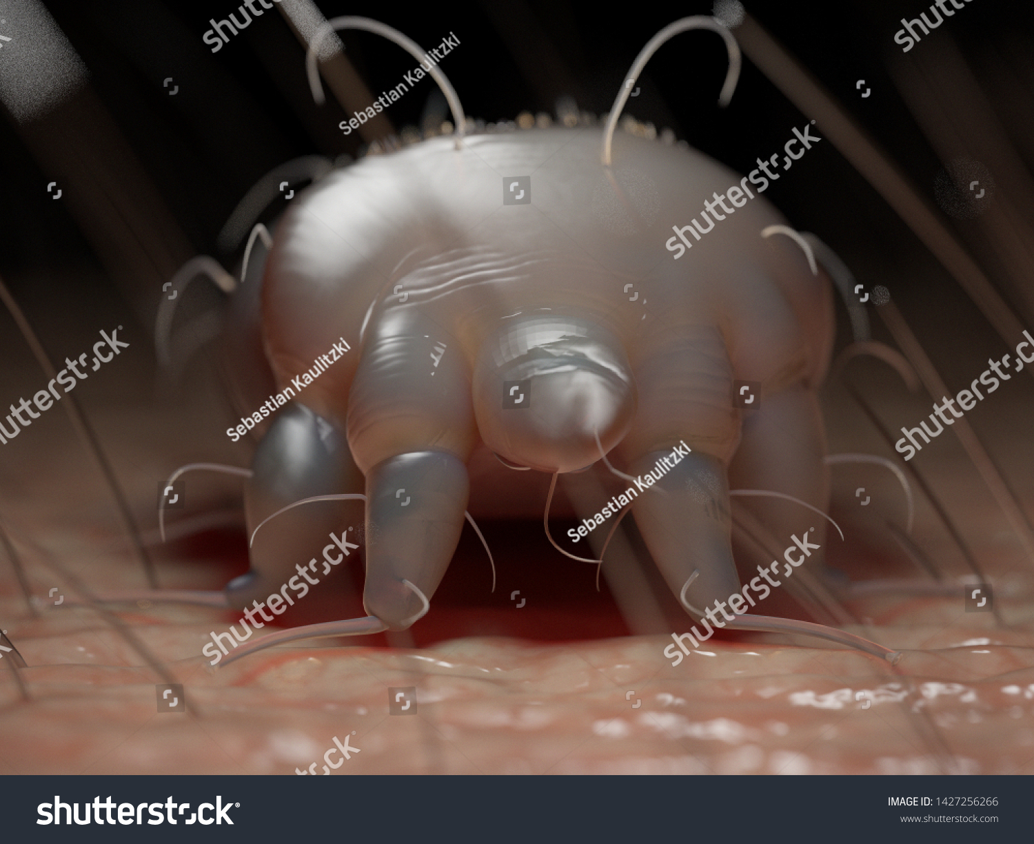 3d Rendered Medically Accurate Illustration Scabies Stock Illustration 1427256266 Shutterstock