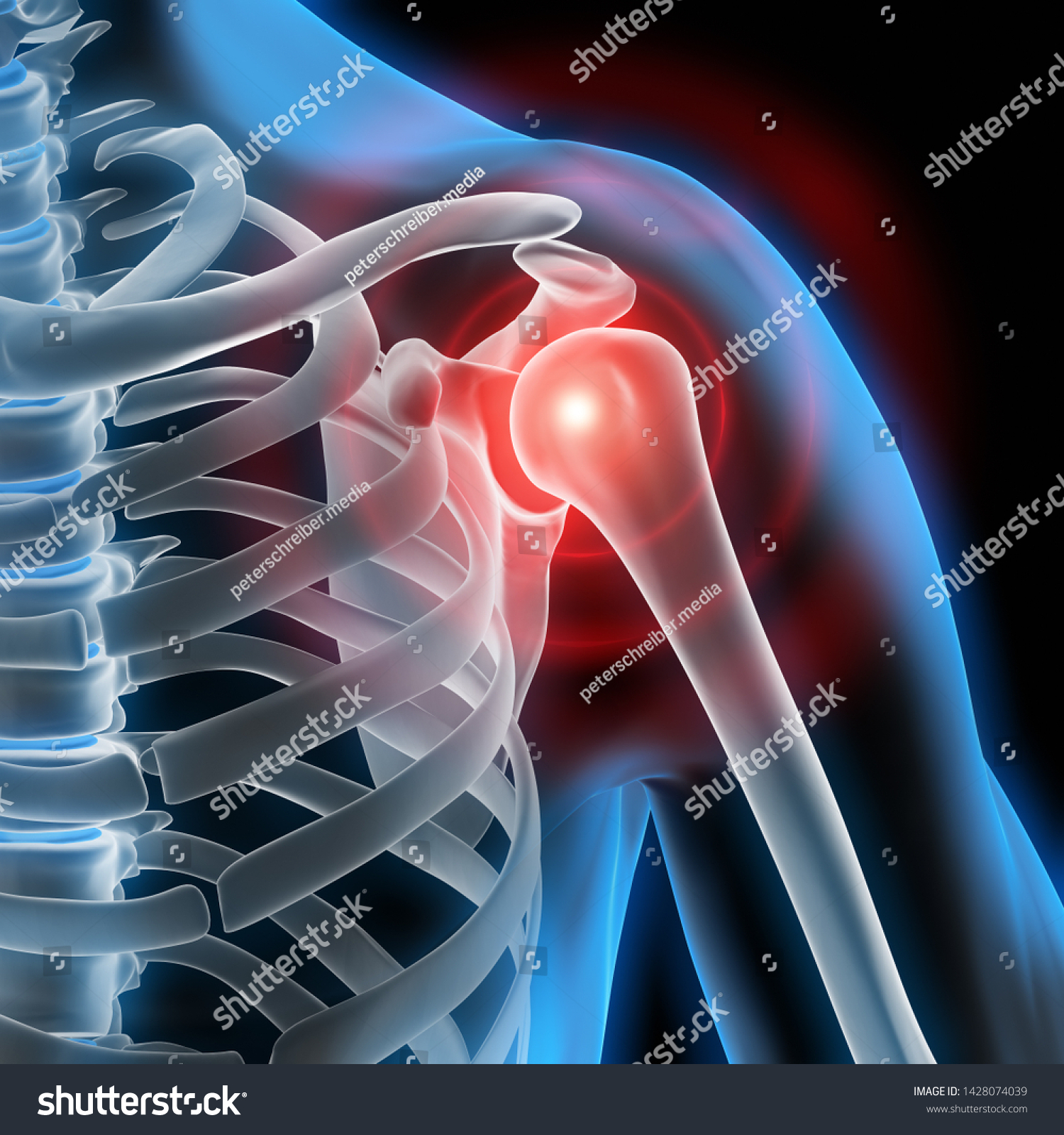 Pain Shoulder Joint 3d Illustration Stock Illustration 1428074039 ...