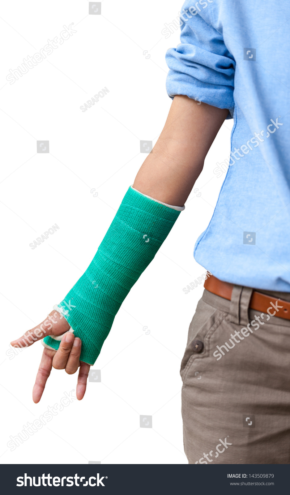 green arm cast