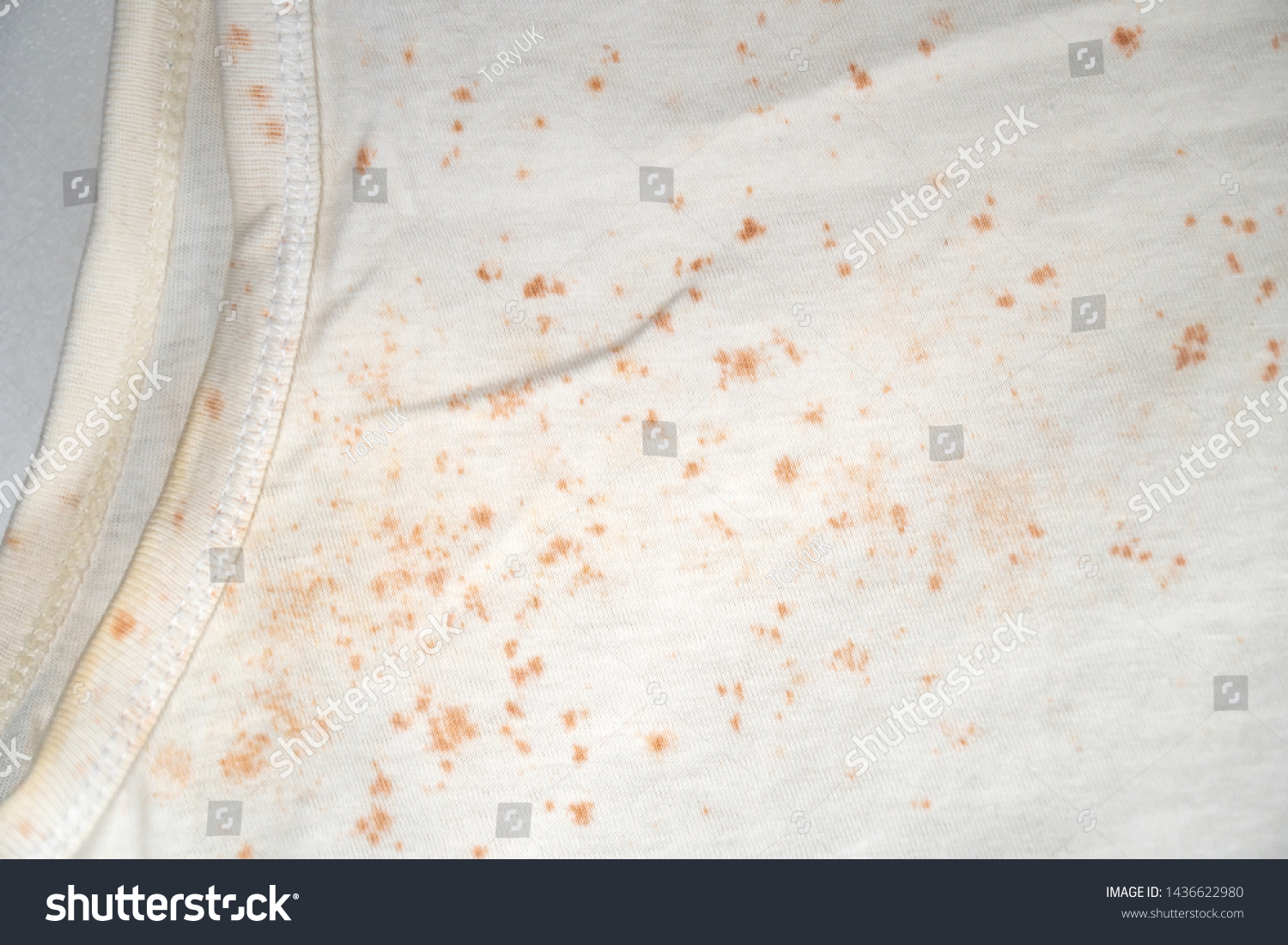 fungus-on-clothes-selective-focus-stock-photo-1436622980-shutterstock