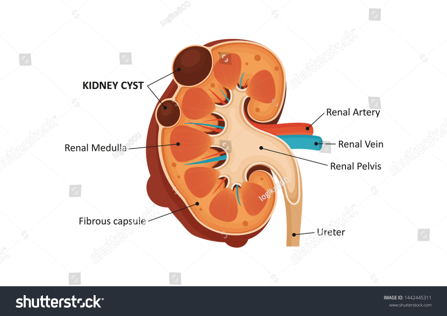 Kidney Cyst Human Kidney Anatomy Stock Illustration 1442445311 