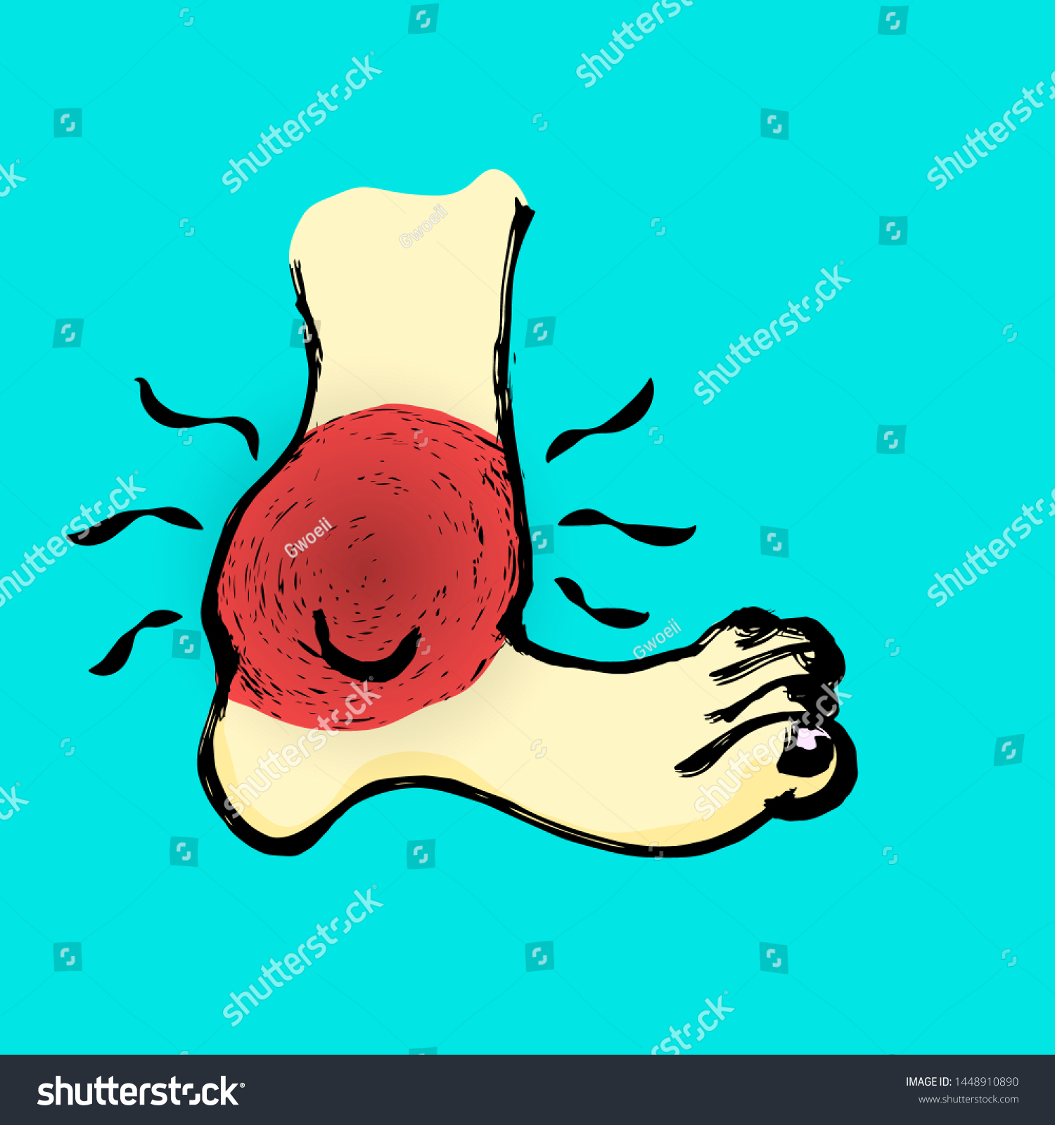 Cartoon Feet Throbbing Swollen Ankle Vector: стоковая векторная графика ...