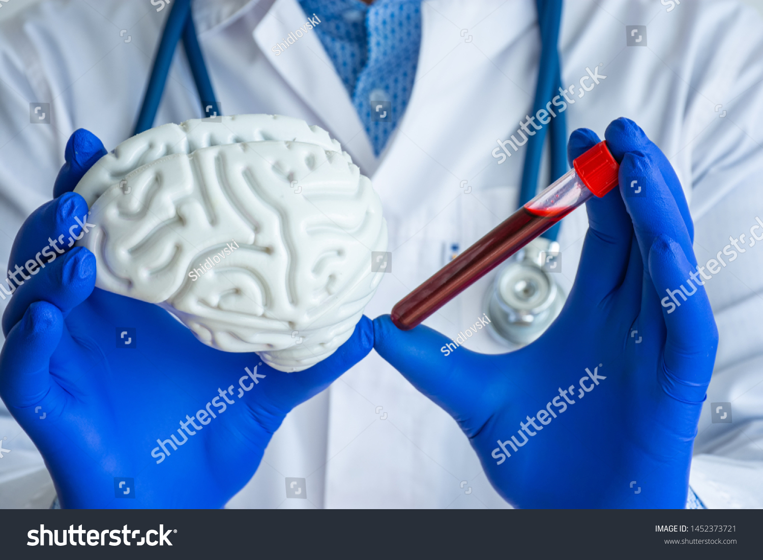 222 Prion disease 이미지, 스톡 사진 및 벡터 | Shutterstock