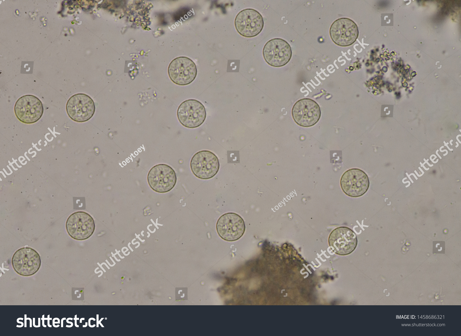 Entamoeba Coli Protozao Cystsstage Stool Exam Stock Photo 1458686321 ...