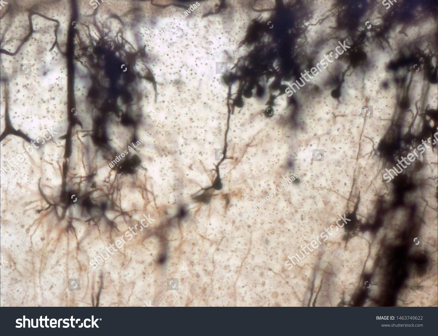 Mouse Brain Section Stained Golgi Stain Stock Photo 1463749622 ...