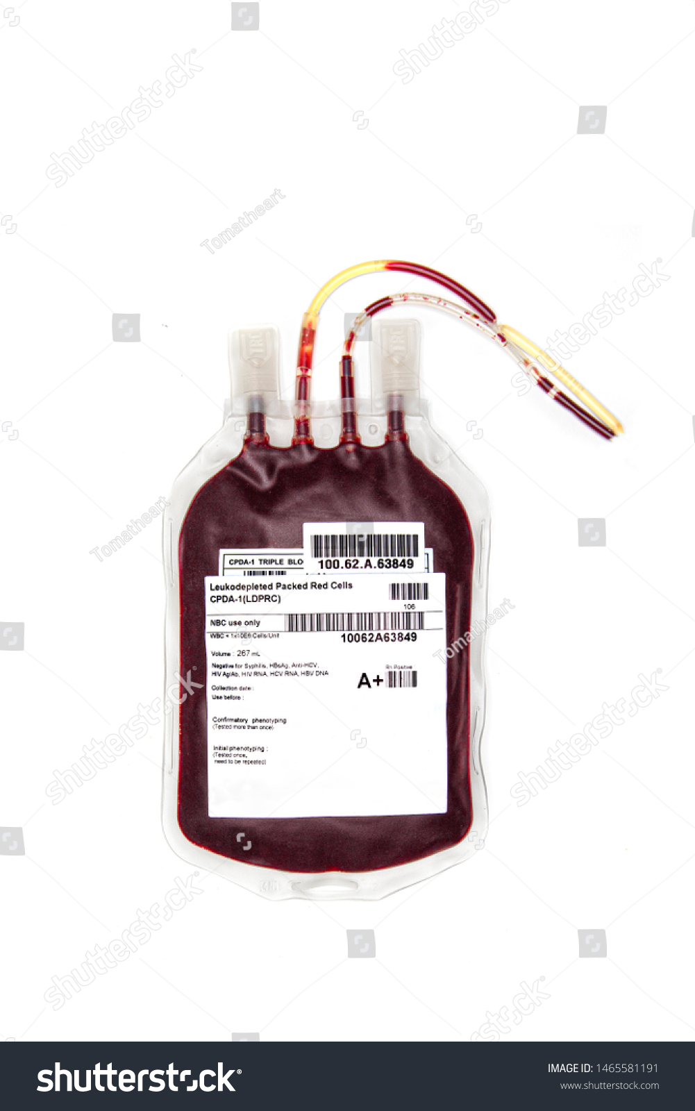 Fresh Blood Packed Red Cells Transfusion Stock Photo 1465581191 ...