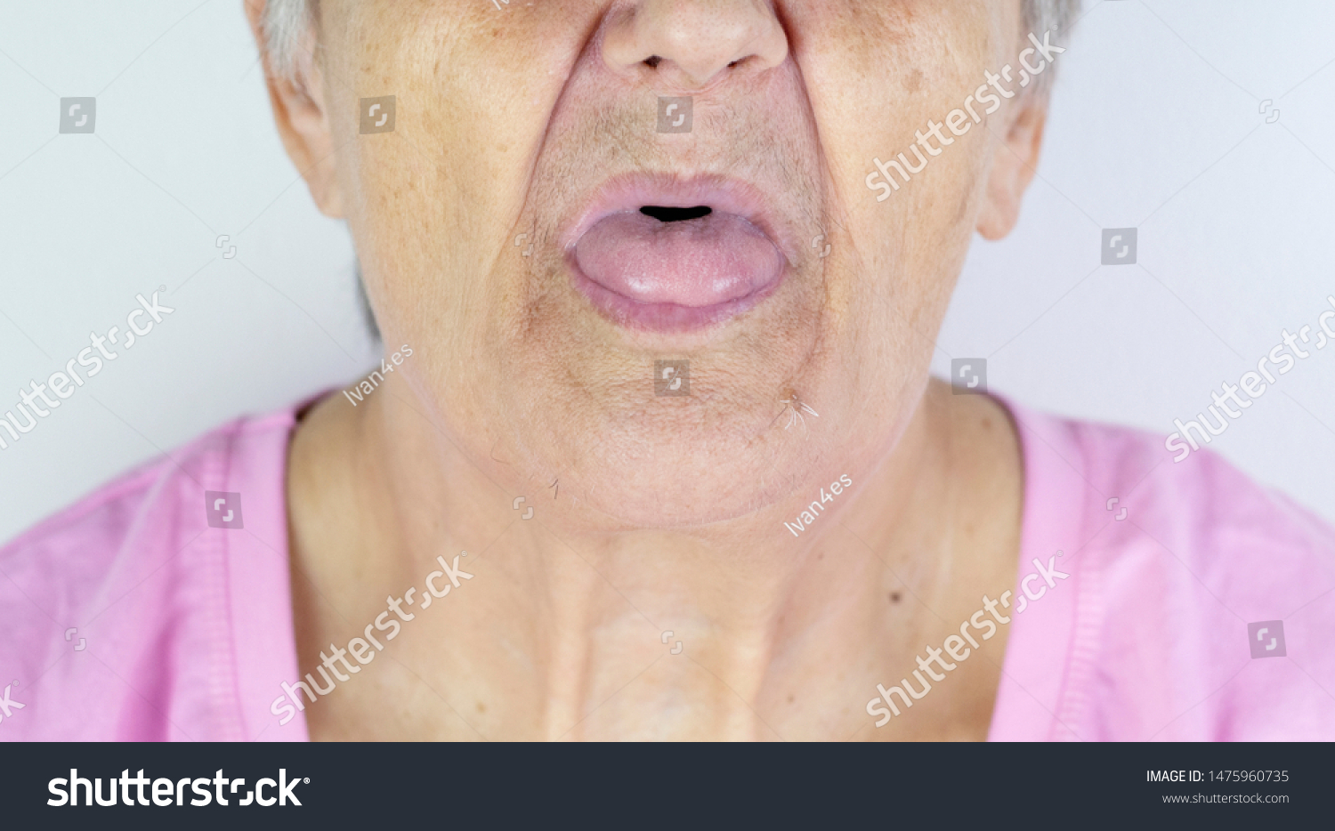 Toothless Mouth Elderly Woman No Teeth: стоковая фотография (редактировать)...