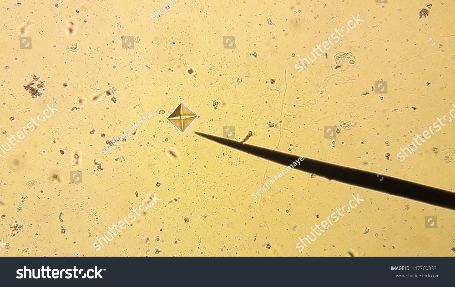 1-023-crystals-in-urine-images-stock-photos-vectors-shutterstock