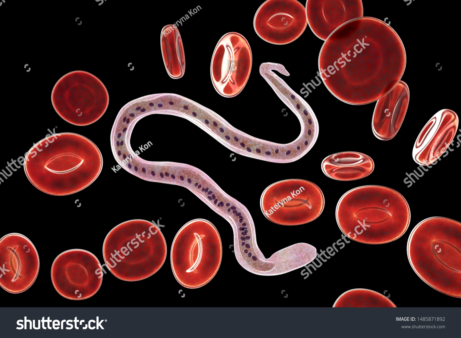 Wuchereria Bancrofti Roundworm Nematode One Causative Stock ...