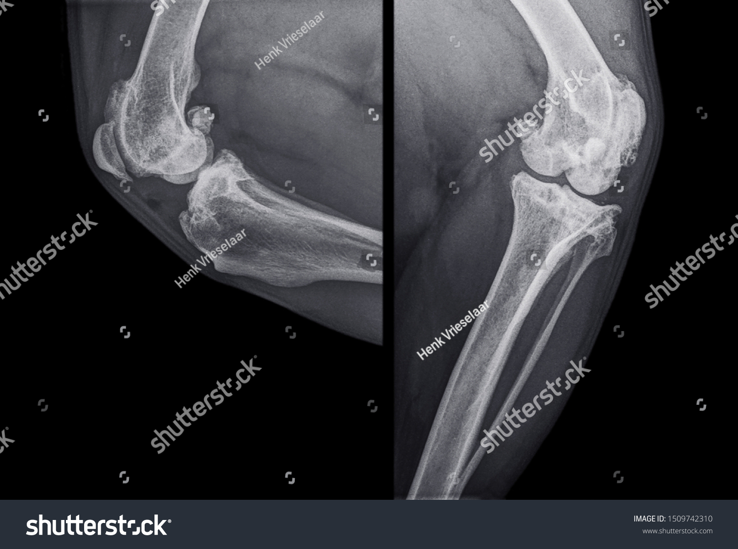 Digital Xray Knee Dog Severe Osteoarthritis Stock Photo 1509742310